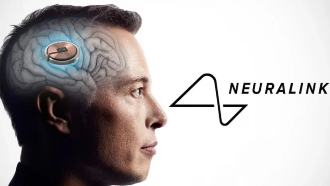 Elon Musk Is Preparing For The First Person To Get His Brain Chip