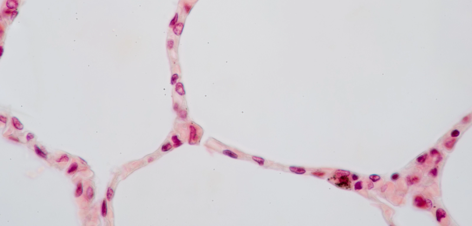 simple squamous epithelium