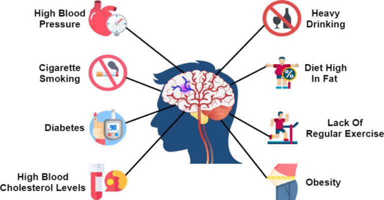 Risk factors for ischemic stroke